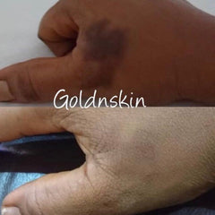 Dark Spot Corrector | Natural Organic Products | GoldnSkin
